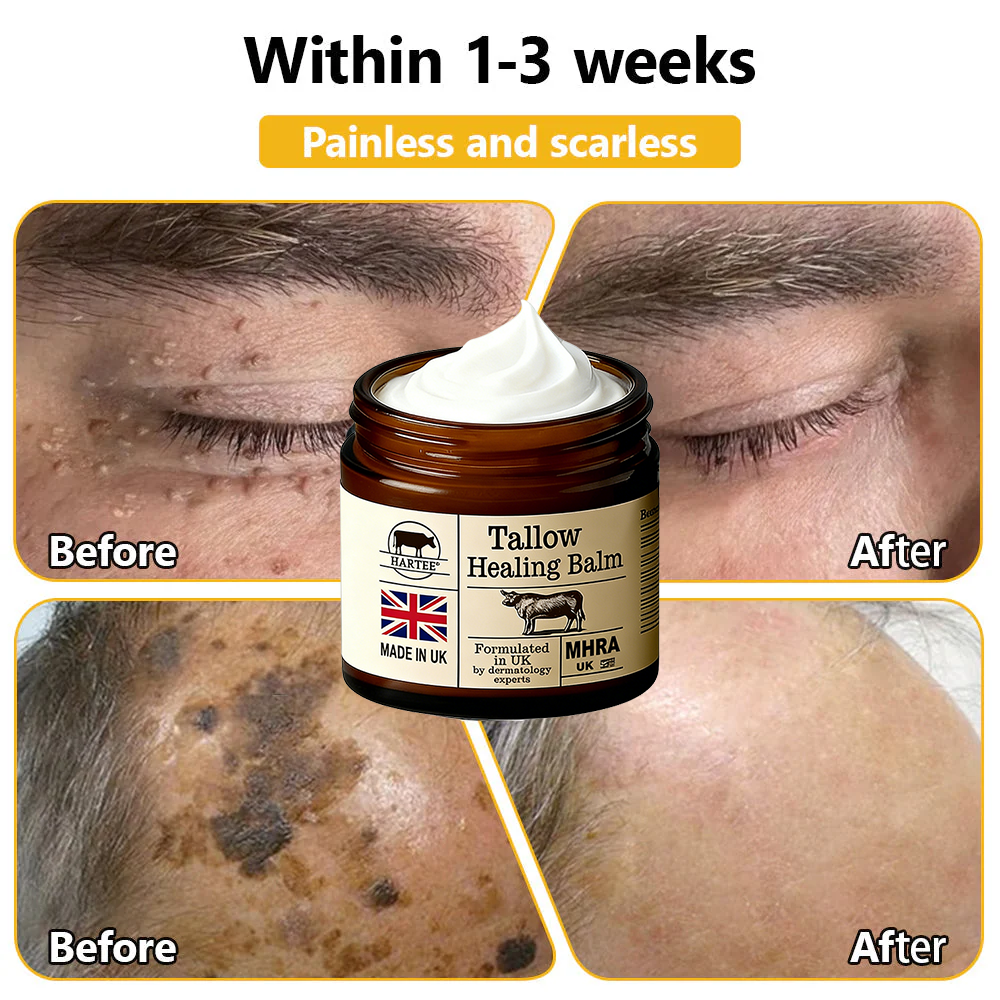 HARTEE® Tallow Healing Balm🐄（GMP Facility • FDA-Registered • Dermatologist Tested👨‍⚕️）Soothe eczema, psoriasis & rosacea—without steroids.🐄