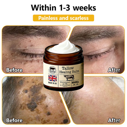 HARTEE® Tallow Healing Balm🐄（GMP Facility • FDA-Registered • Dermatologist Tested👨‍⚕️）Soothe eczema, psoriasis & rosacea—without steroids.🐄