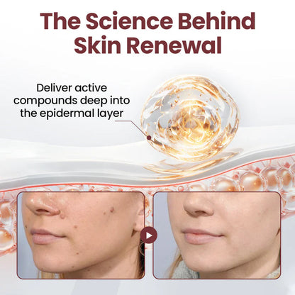 HARTEE® Tallow Healing Balm🐄（GMP Facility • FDA-Registered • Dermatologist Tested👨‍⚕️）Soothe eczema, psoriasis & rosacea—without steroids.🐄