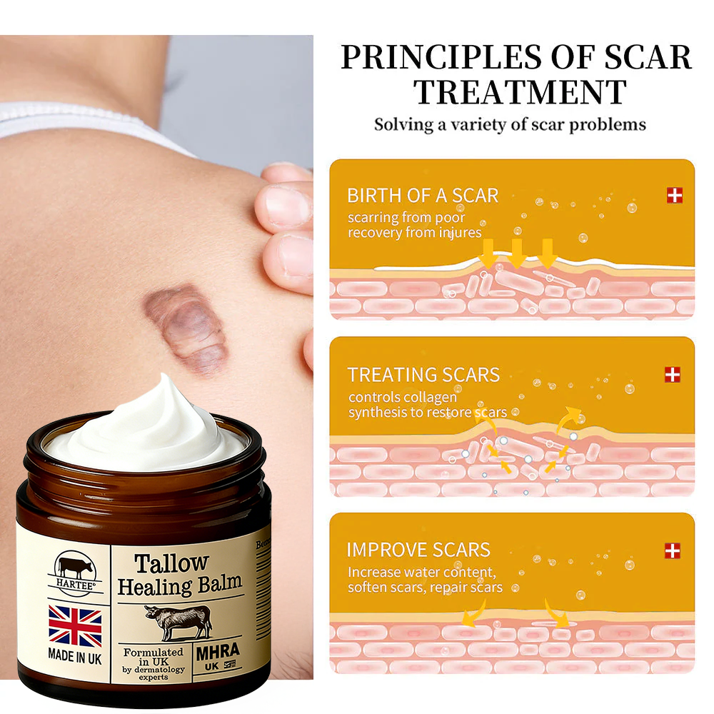 HARTEE® Tallow Healing Balm🐄（GMP Facility • FDA-Registered • Dermatologist Tested👨‍⚕️）Soothe eczema, psoriasis & rosacea—without steroids.🐄