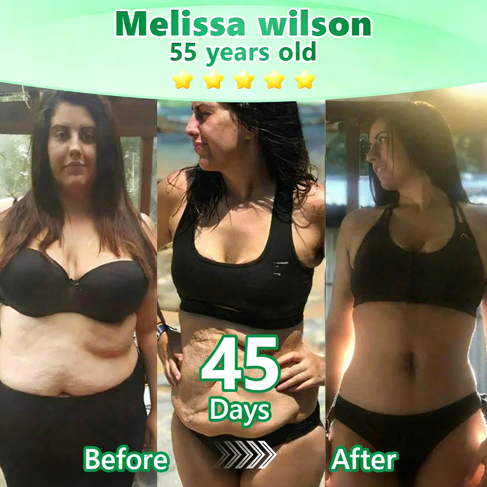 【𝐿𝑎𝑠𝑡 𝐷𝑎𝑦 𝑃𝑟𝑜𝑚𝑜𝑡𝑖𝑜𝑛 70% 𝑂𝐹𝐹】|𝙋𝙪𝙧𝙚𝙡𝙪𝙭𝙤® Caffeine · L-Carnitine × Retinol | Slimming & Firming 2-in-1 Nano Microneedle Patch🇬🇧|𝘉𝘢𝘤𝘬𝘦𝘥 𝘣𝘺 𝘴𝘤𝘪𝘦𝘯𝘤𝘦 | 10-𝗂𝗇-𝟣 𝖿𝗈𝗋𝗆𝗎𝗅𝖺 | 𝑅𝑒𝑠𝑢𝑙𝑡𝑠 𝑖𝑛 7 𝑑𝑎𝑦𝑠 ⏳