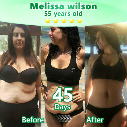 【𝐿𝑎𝑠𝑡 𝐷𝑎𝑦 𝑃𝑟𝑜𝑚𝑜𝑡𝑖𝑜𝑛 70% 𝑂𝐹𝐹】|𝙋𝙪𝙧𝙚𝙡𝙪𝙭𝙤® Caffeine · L-Carnitine × Retinol | Slimming & Firming 2-in-1 Nano Microneedle Patch🇬🇧|𝘉𝘢𝘤𝘬𝘦𝘥 𝘣𝘺 𝘴𝘤𝘪𝘦𝘯𝘤𝘦 | 10-𝗂𝗇-𝟣 𝖿𝗈𝗋𝗆𝗎𝗅𝖺 | 𝑅𝑒𝑠𝑢𝑙𝑡𝑠 𝑖𝑛 7 𝑑𝑎𝑦𝑠 ⏳