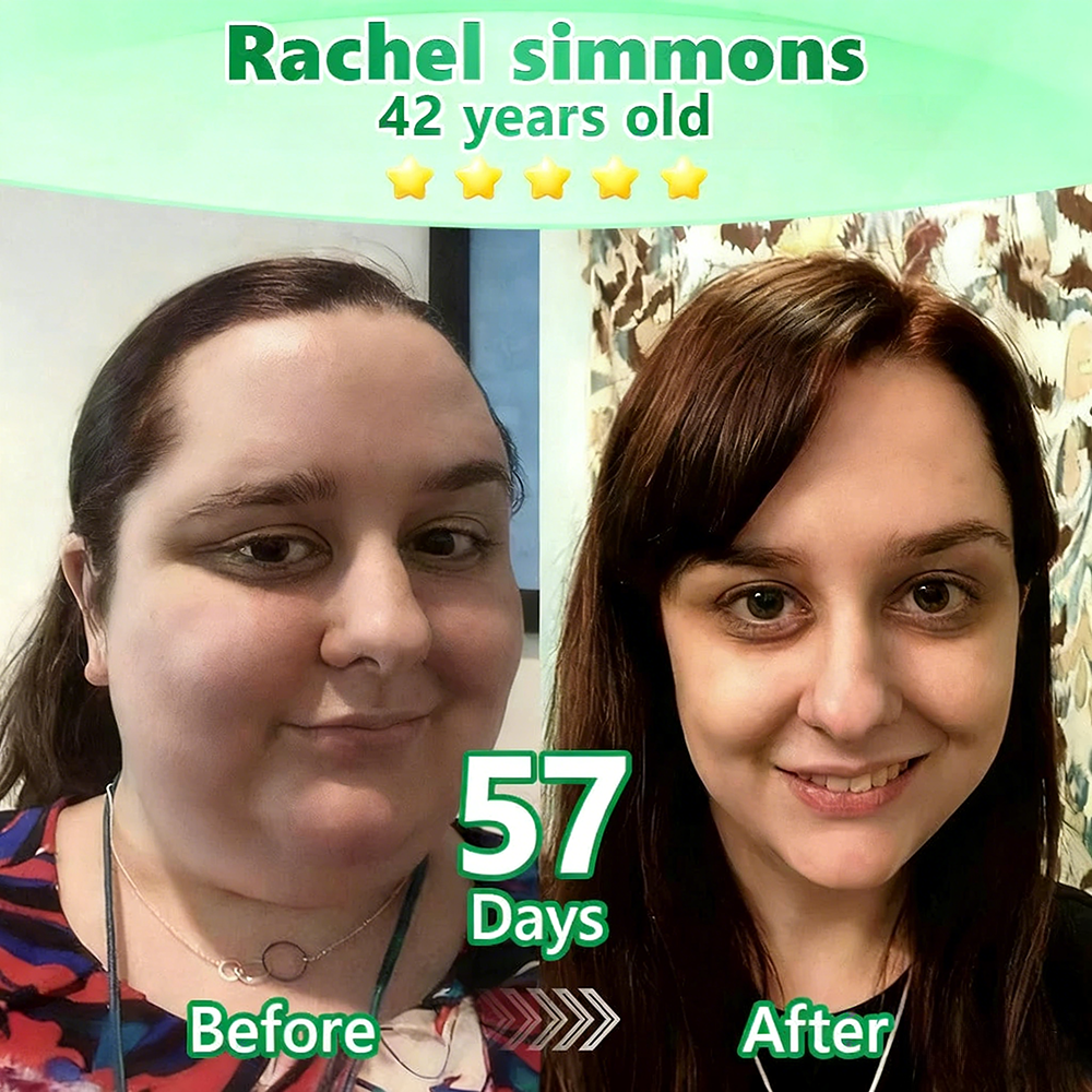 【𝐿𝑎𝑠𝑡 𝐷𝑎𝑦 𝑃𝑟𝑜𝑚𝑜𝑡𝑖𝑜𝑛 70% 𝑂𝐹𝐹】|𝙋𝙪𝙧𝙚𝙡𝙪𝙭𝙤® Caffeine · L-Carnitine × Retinol | Slimming & Firming 2-in-1 Nano Microneedle Patch🇬🇧|𝘉𝘢𝘤𝘬𝘦𝘥 𝘣𝘺 𝘴𝘤𝘪𝘦𝘯𝘤𝘦 | 10-𝗂𝗇-𝟣 𝖿𝗈𝗋𝗆𝗎𝗅𝖺 | 𝑅𝑒𝑠𝑢𝑙𝑡𝑠 𝑖𝑛 7 𝑑𝑎𝑦𝑠 ⏳