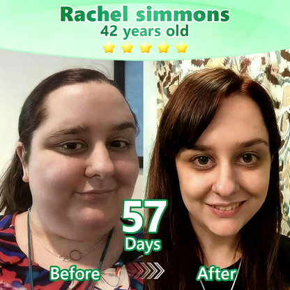 【𝐿𝑎𝑠𝑡 𝐷𝑎𝑦 𝑃𝑟𝑜𝑚𝑜𝑡𝑖𝑜𝑛 70% 𝑂𝐹𝐹】|𝙋𝙪𝙧𝙚𝙡𝙪𝙭𝙤® Caffeine · L-Carnitine × Retinol | Slimming & Firming 2-in-1 Nano Microneedle Patch🇬🇧|𝘉𝘢𝘤𝘬𝘦𝘥 𝘣𝘺 𝘴𝘤𝘪𝘦𝘯𝘤𝘦 | 10-𝗂𝗇-𝟣 𝖿𝗈𝗋𝗆𝗎𝗅𝖺 | 𝑅𝑒𝑠𝑢𝑙𝑡𝑠 𝑖𝑛 7 𝑑𝑎𝑦𝑠 ⏳