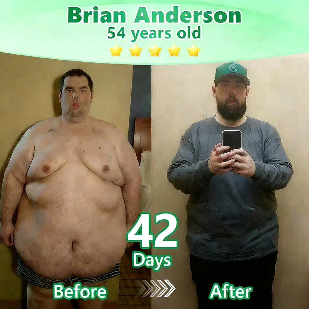 【𝐿𝑎𝑠𝑡 𝐷𝑎𝑦 𝑃𝑟𝑜𝑚𝑜𝑡𝑖𝑜𝑛 70% 𝑂𝐹𝐹】|𝙋𝙪𝙧𝙚𝙡𝙪𝙭𝙤® Caffeine · L-Carnitine × Retinol | Slimming & Firming 2-in-1 Nano Microneedle Patch🇬🇧|𝘉𝘢𝘤𝘬𝘦𝘥 𝘣𝘺 𝘴𝘤𝘪𝘦𝘯𝘤𝘦 | 10-𝗂𝗇-𝟣 𝖿𝗈𝗋𝗆𝗎𝗅𝖺 | 𝑅𝑒𝑠𝑢𝑙𝑡𝑠 𝑖𝑛 7 𝑑𝑎𝑦𝑠 ⏳