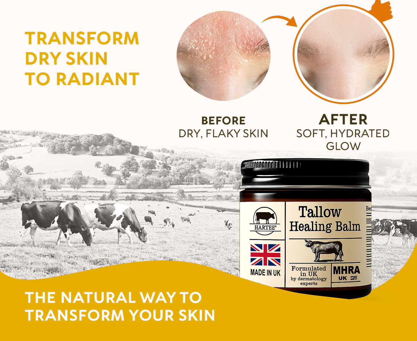 HARTEE® Tallow Healing Balm🐄（GMP Facility • FDA-Registered • Dermatologist Tested👨‍⚕️）Soothe eczema, psoriasis & rosacea—without steroids.🐄