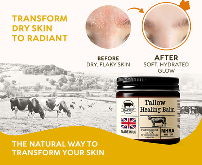 HARTEE® Tallow Healing Balm🐄（GMP Facility • FDA-Registered • Dermatologist Tested👨‍⚕️）Soothe eczema, psoriasis & rosacea—without steroids.🐄