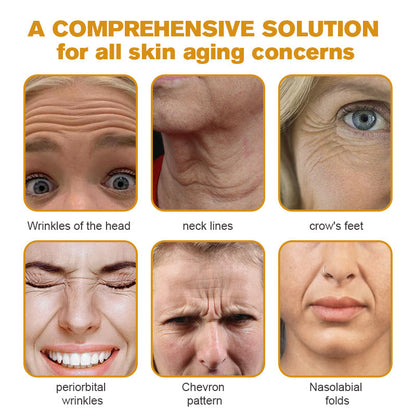 🧑‍⚕️Botox Bee Venom Wrinkle Removal Cream- LAST DAY 70% OFF🔥