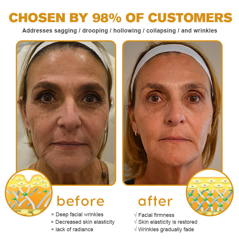 🧑‍⚕️Botox Bee Venom Wrinkle Removal Cream- LAST DAY 70% OFF🔥