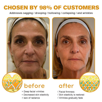 🧑‍⚕️Botox Bee Venom Wrinkle Removal Cream- LAST DAY 70% OFF🔥